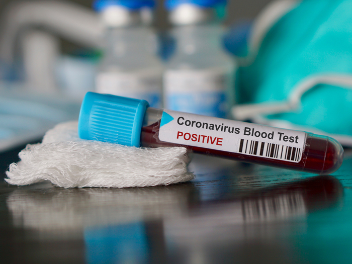 How Can I Keep My Employees Safe from the Coronavirus?